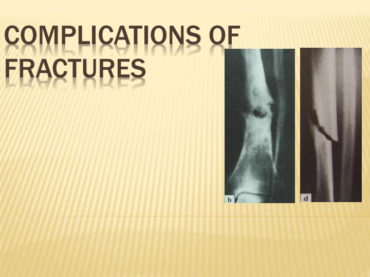 Page 1 – Complications of Fractures PowerPoint Notes (Certificate in Orthopaedic and Trauma Medicine) – Kenyaplex