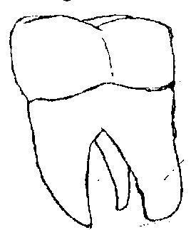 tooth30092016.png